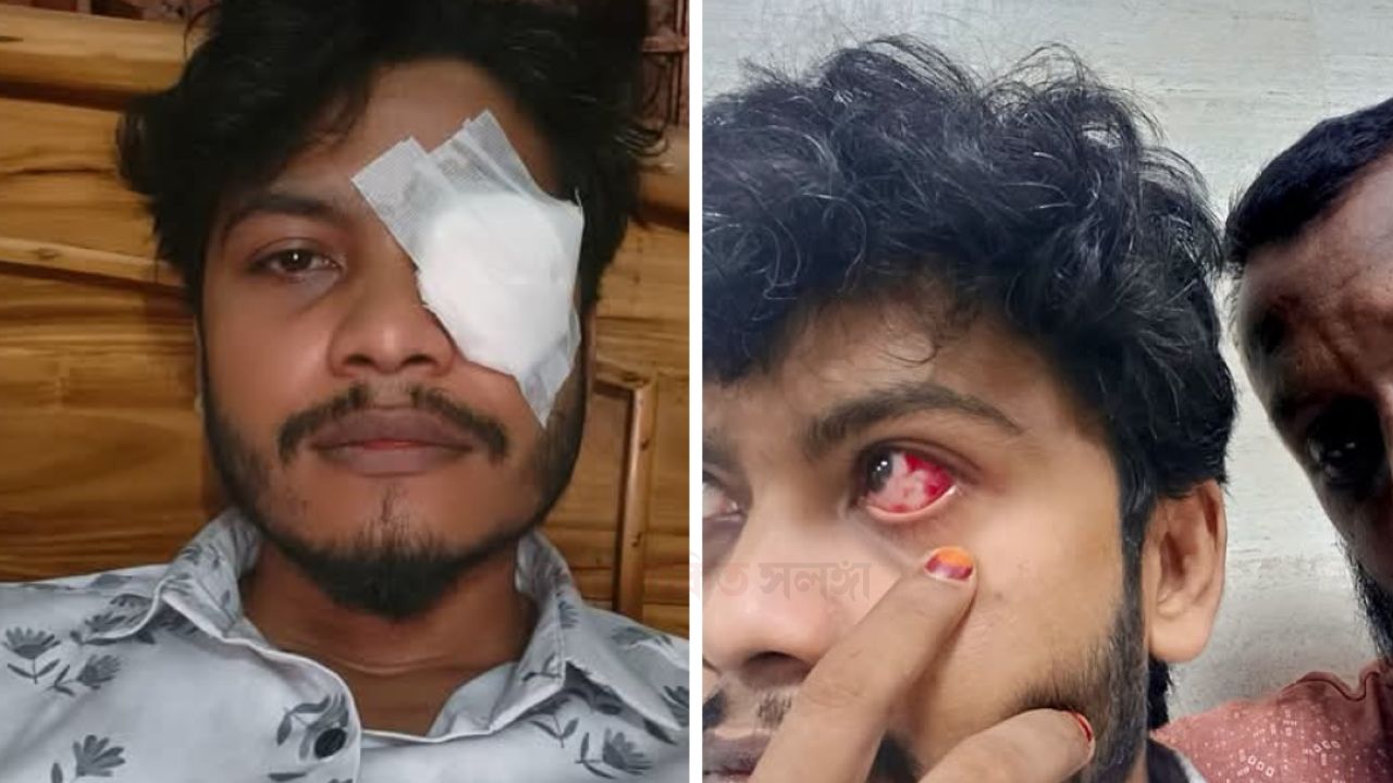 বনানী স্ট্যান্ডে সিএনজি-অটোরিকশা সংঘর্ষে আহত সাংবাদিক আরিফুল ইসলাম, চোখে অস্ত্রোপচারের পরামর্শ