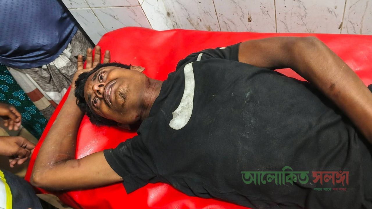 চলন্ত ট্রেনের ছাদ থেকে পড়ে গোপালপুরে আহত ২​